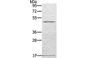 Western blot analysis of Human normal stomach tissue, using KDM8 Polyclonal Antibody at dilution of 1:500 (JMJD5 Antikörper)