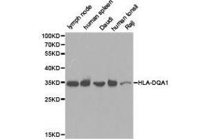 Western Blotting (WB) image for anti-Major Histocompatibility Complex, Class II, DQ alpha 1 (HLA-DQA1) antibody (ABIN1873029) (HLA-DQA1 Antikörper)