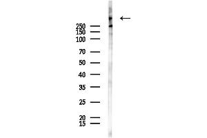 anti-helicase 2, X-linked (ATRX) (N-Term) antibody