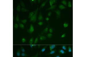 Immunofluorescence analysis of HeLa cells using ARRB1 Polyclonal Antibody (beta Arrestin 1 Antikörper)