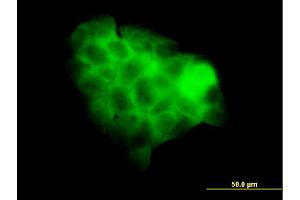 Immunofluorescence of monoclonal antibody to STAT2 on A-431 cell. (STAT2 Antikörper  (AA 742-851))
