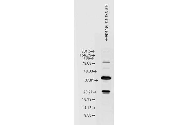 HSPB8 Antikörper  (HRP)
