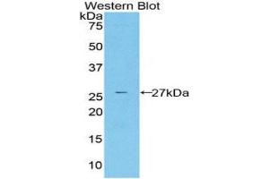 Western Blotting (WB) image for anti-Cysteine-Rich, Angiogenic Inducer, 61 (CYR61) (AA 178-381) antibody (ABIN1858600) (CYR61 Antikörper  (AA 178-381))