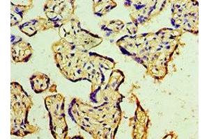 Immunohistochemistry of paraffin-embedded human placenta tissue using ABIN7150706 at dilution of 1:100 (MAP2K3 Antikörper  (AA 1-170))