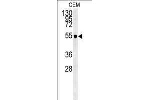 ZIC3 Antibody (Center) (ABIN650719 and ABIN2839389) western blot analysis in CEM cell line lysates (35 μg/lane). (ZIC3 Antikörper  (AA 239-267))