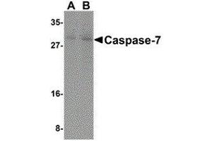 Western Blotting (WB) image for anti-Caspase 7, Apoptosis-Related Cysteine Peptidase (CASP7) (N-Term) antibody (ABIN2477919) (Caspase 7 Antikörper  (N-Term))