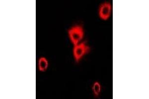 Immunofluorescent analysis of Alpha-tubulin 4a staining in Hela cells. (TUBA4A Antikörper)