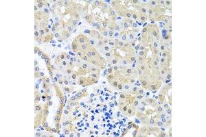 Immunohistochemistry of paraffin-embedded mouse kidney using BSND antibody. (BSND Antikörper  (AA 54-320))