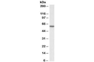 Western blot testing of human HeLa cell lysate with KPNA3 antibody at 0. (KPNA3 Antikörper)