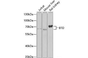 Western blot analysis of extracts of various cell lines using BTD Polyclonal Antibody at dilution of 1:1000. (BTD Antikörper)
