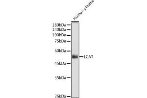 Western blot analysis of extracts of Human plasma, using LCAT antibody (ABIN6130520, ABIN6143108, ABIN6143110 and ABIN6215439) at 1:1000 dilution. (LCAT Antikörper  (AA 25-440))