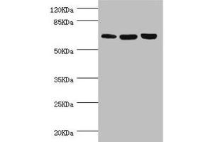 Western blot All lanes: CTNNBL1 antibody at 5. (CTNNBL1 Antikörper  (AA 264-563))