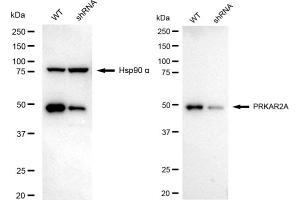 Western blotting analysis using PRKAR2A antibody (ABIN7800012).