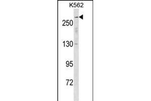 Western Blotting (WB) image for anti-Sodium Channel, Voltage-Gated, Type V, alpha Subunit (SCN5A) (AA 42-70), (N-Term) antibody (ABIN1539374)
