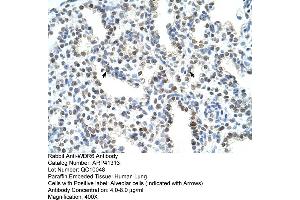 Rabbit Anti-WDR6 Antibody  Paraffin Embedded Tissue: Human Lung Cellular Data: Alveolar cells Antibody Concentration: 4. (WDR6 Antikörper  (C-Term))