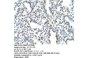 Rabbit Anti-WDR6 Antibody  Paraffin Embedded Tissue: Human Lung Cellular Data: Alveolar cells Antibody Concentration: 4. (WDR6 Antikörper  (C-Term))