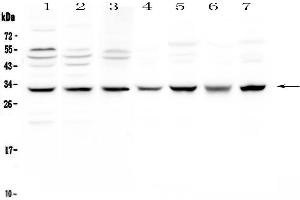Western Blotting (WB) image for anti-Succinate Dehydrogenase Complex, Subunit B, Iron Sulfur (Ip) (SDHB) (AA 29-280) antibody (ABIN5693211)