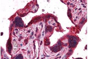 Human Placenta: Formalin-Fixed, Paraffin-Embedded (FFPE) (DPP8 Antikörper  (AA 1-39))