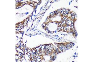 Immunohistochemistry (IHC) image for anti-Asparagine-Linked Glycosylation 5, Dolichyl-Phosphate beta-Glucosyltransferase Homolog (S. Cerevisiae) (ALG5) (AA 34-190) antibody (ABIN7265696)