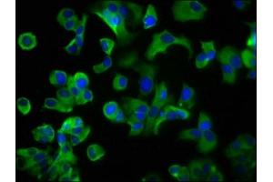 Immunofluorescence staining of MCF-7 cells with ABIN7158571 at 1:200, counter-stained with DAPI. (LRP2 Antikörper  (AA 202-332))