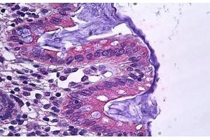 Human Colon, Epithelium: Formalin-Fixed, Paraffin-Embedded (FFPE)