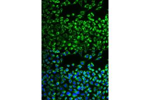 Immunofluorescence analysis of MCF-7 cells using CYP51A1 antibody. (CYP51A1 Antikörper)