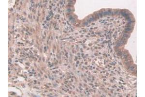IHC-P analysis of Mouse Uterus Tissue, with DAB staining. (FAP Antikörper  (AA 542-761))