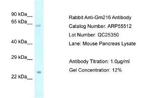Western Blotting (WB) image for anti-Predicted Gene 216 (GM216) (Middle Region) antibody (ABIN2786243) (GM216 Antikörper  (Middle Region))