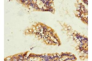 Immunohistochemistry of paraffin-embedded human small intestine tissue using ABIN7172867 at dilution of 1:100 (TRPM4 Antikörper  (AA 1-240))