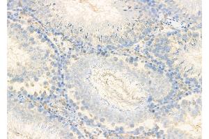 ABIN6261363 and ABIN6278853 at 1/100 staining Rat testis tissue by IHC-P. (CALY Antikörper  (Internal Region))