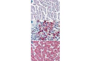 Immunohistochemistry (Formalin/PFA-fixed paraffin-embedded sections) of human heart (A), human spleen (B) and human liver tissue (C) tissue with CYSLTR2 polyclonal antibody . (CasLTR2 Antikörper  (N-Term))