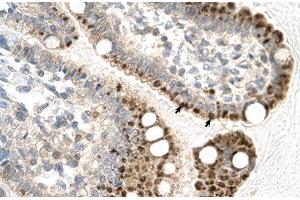 Human Intestine; Rabbit Anti-ZFP1 Antibody. (Zfp-1 Antikörper  (N-Term))