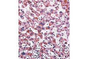 CYP2C9 Antibody (N-term) ((ABIN392355 and ABIN2841994))immunohistochemistry analysis in formalin fixed and paraffin embedded human liver tissue followed by peroxidase conjugation of the secondary antibody and DAB staining. (CYP2C9 Antikörper  (N-Term))