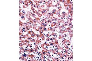 CYP2C9 Antibody (N-term) ((ABIN392355 and ABIN2841994))immunohistochemistry analysis in formalin fixed and paraffin embedded human liver tissue followed by peroxidase conjugation of the secondary antibody and DAB staining. (CYP2C9 Antikörper  (N-Term))