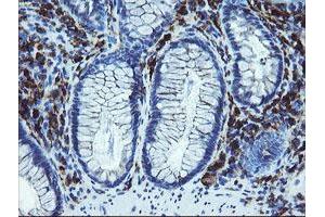 Immunohistochemical staining of paraffin-embedded Human colon tissue using anti-LRRC25 mouse monoclonal antibody. (LRRC25 Antikörper)