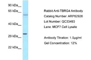 Western Blotting (WB) image for anti-Transforming Growth Factor beta Regulator 4 (TBRG4) (C-Term) antibody (ABIN2789300) (TBRG4 Antikörper  (C-Term))