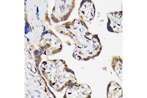 Immunohistochemistry of paraffin-embedded human placenta using LIN28B Rabbit mAb (ABIN7268267) at dilution of 1:100 (40x lens).