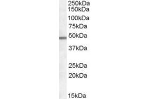 Western Blotting (WB) image for anti-Family with Sequence Similarity 188, Member B (FAM188B) (N-Term) antibody (ABIN2156837) (FAM188B Antikörper  (N-Term))