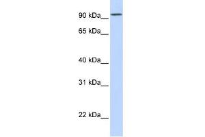 WB Suggested Anti-DPP6 Antibody Titration:  0.