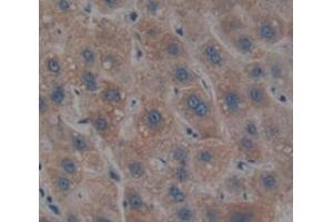 IHC-P analysis of Human Tissue, with DAB staining. (PIK3CB Antikörper  (AA 524-703))