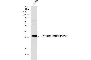 WB Image Triosephosphate isomerase antibody detects Triosephosphate isomerase protein by western blot analysis. (TPI1 Antikörper  (C-Term))
