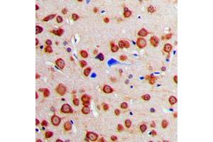 Immunohistochemical analysis of Calmodulin staining in human brain formalin fixed paraffin embedded tissue section. (Calmodulin 1 Antikörper  (Center))