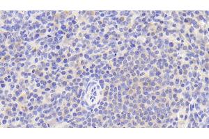 Immunohistochemistry (IHC) image for anti-CD5 (CD5) (AA 25-372) antibody (ABIN7445102)