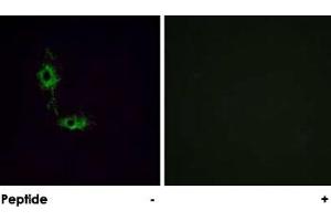 Immunofluorescence analysis of HeLa cells, using GRIA1 polyclonal antibody . (Glutamate Receptor 1 Antikörper)