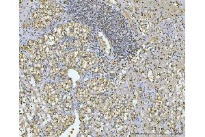 IHC analysis of GAPDH using anti-GAPDH antibody (ABIN5518757).