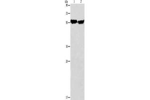 Gel: 8 % SDS-PAGE, Lysate: 40 μg, Lane 1-2: Mouse heart tissue, human fetal brain tissue, Primary antibody: ABIN7128507(ARHGEF9 Antibody) at dilution 1/950, Secondary antibody: Goat anti rabbit IgG at 1/8000 dilution, Exposure time: 5 seconds (Arhgef9 Antikörper)