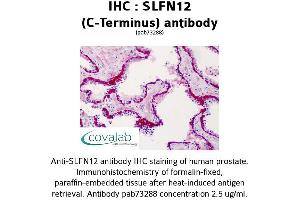 Image no. 1 for anti-Schlafen Family Member 12 (SLFN12) (C-Term) antibody (ABIN1739425) (SLFN12 Antikörper  (C-Term))
