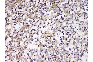 IHC analysis of IGLL1 using anti-IGLL1 antibody (ABIN6719329).