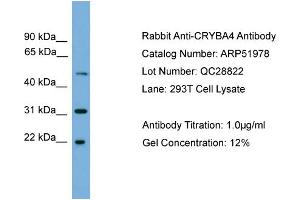 WB Suggested Anti-CRYBA4  Antibody Titration: 0.