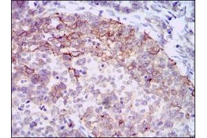 Immunohistochemistry (IHC) image for anti-Hyaluronan Synthase 3 (HAS3) antibody (ABIN969525)